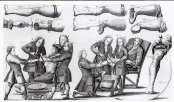 Les maladies et les soins en Corse au XVIIIe siècle